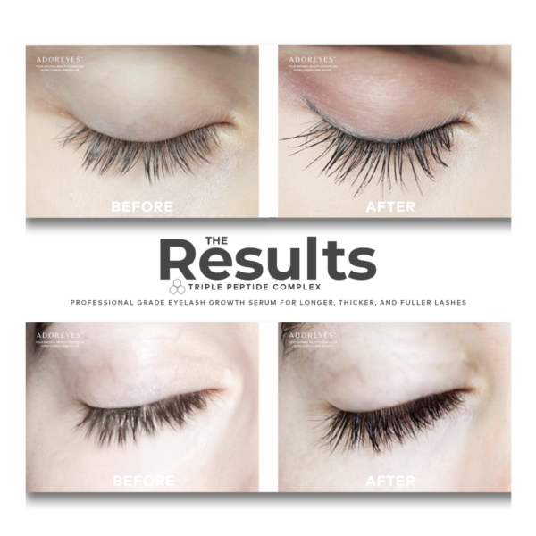 Adoreyes Plus Lash Serum 6ml - Before & After